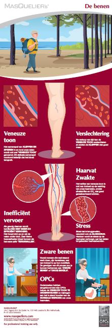 Infographic preview